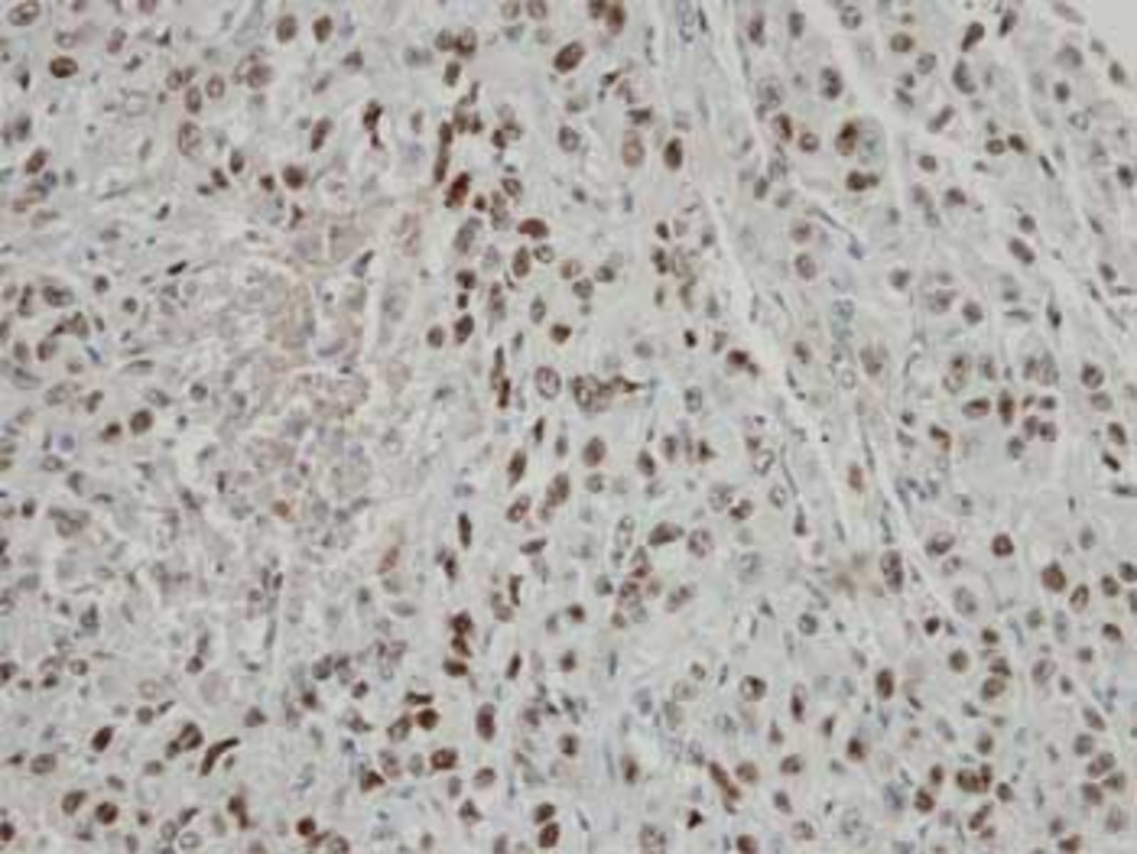 Anti-CSN2 Rabbit Polyclonal Antibody | VWR, part of Avantor