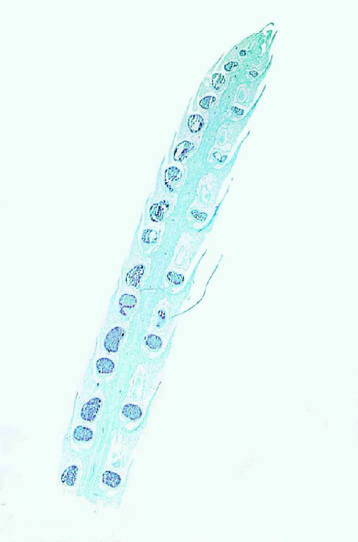 Lycopoduim, Mature Strobilus Slide
