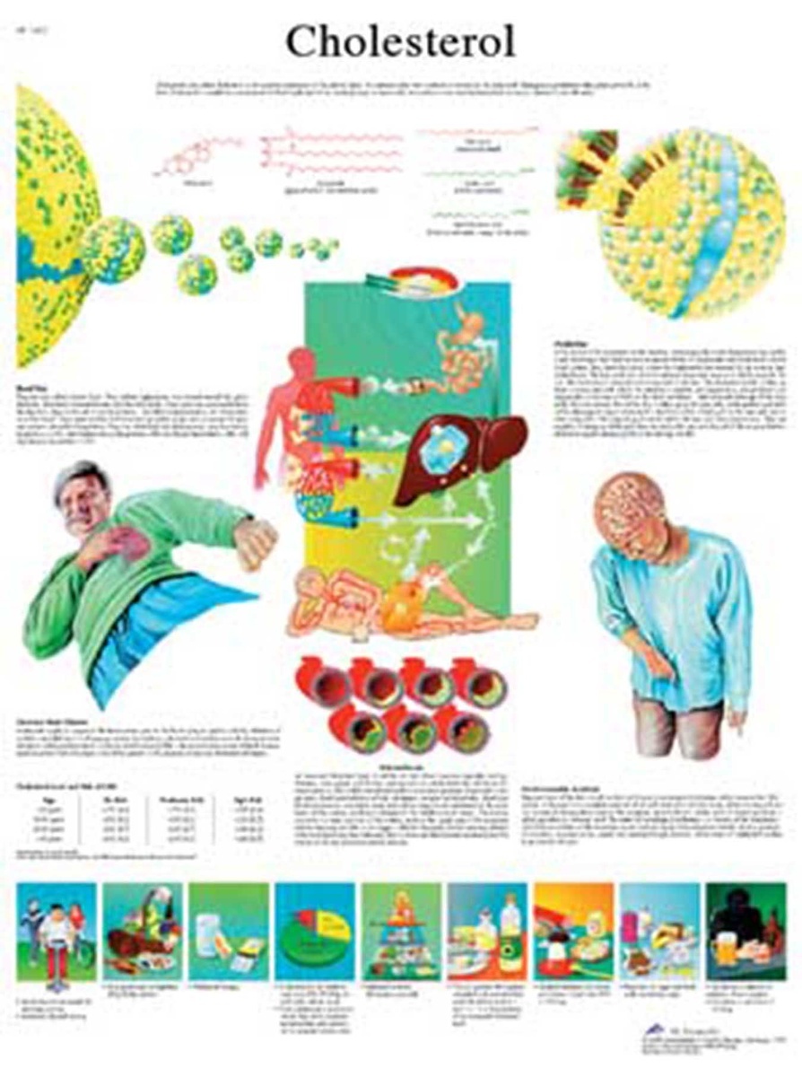 3B Scientific® Cholesterol Chart