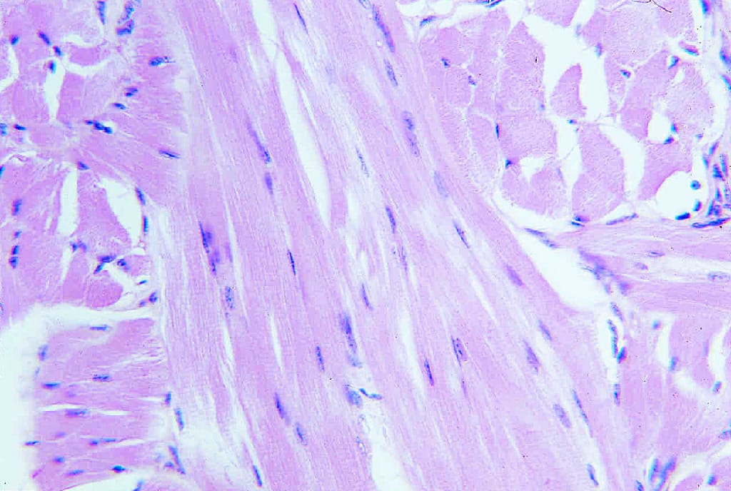 Skeletal Muscle, Primate Slide