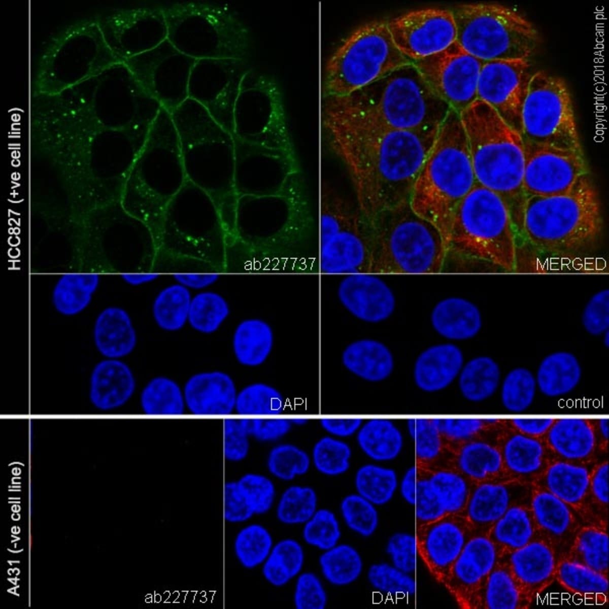 Anti-EGFR Rabbit Monoclonal Antibody [clone: SP111] | VWR, part of Avantor
