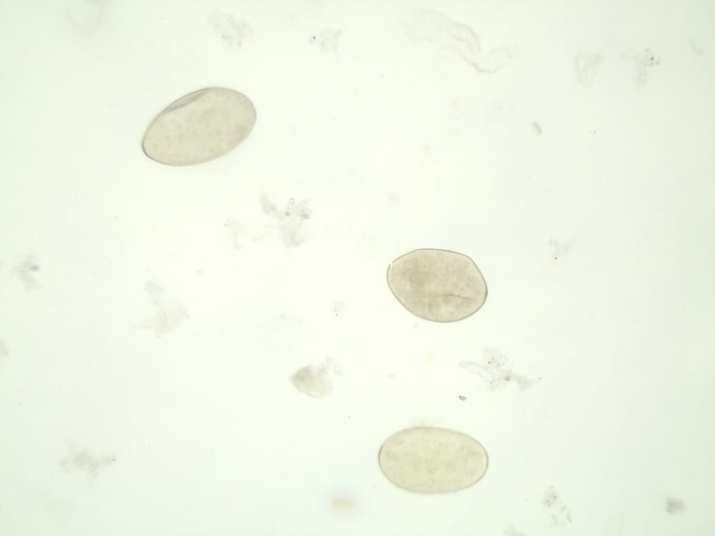 Fasciola hepatica, Eggs Slide