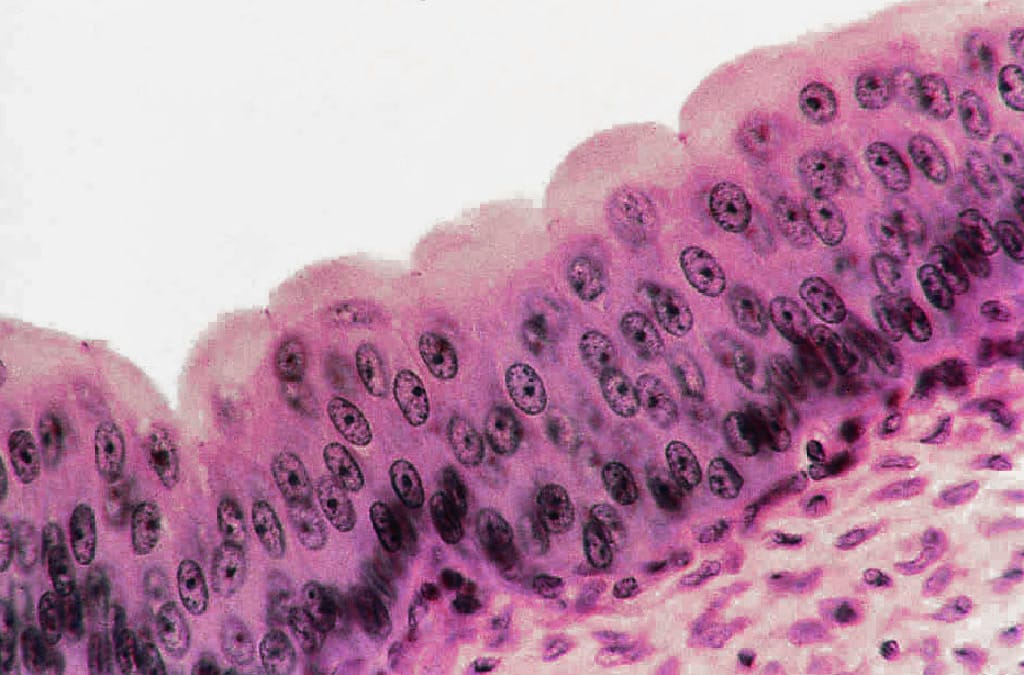 Urinary Bladder, Collapsed Slide