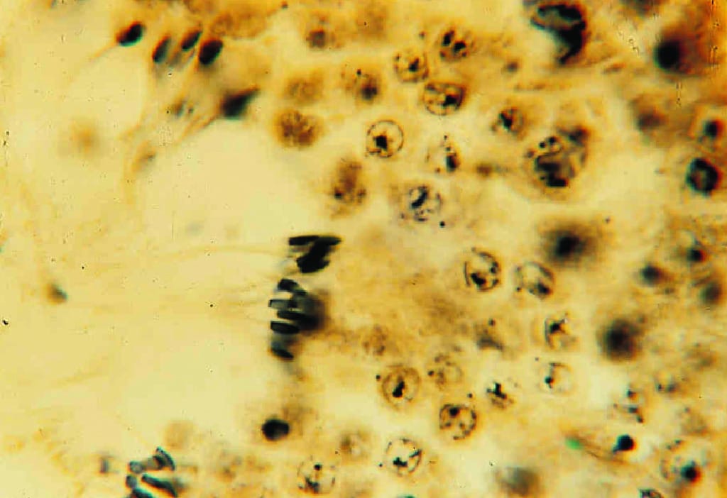 Spermatogenesis Slide