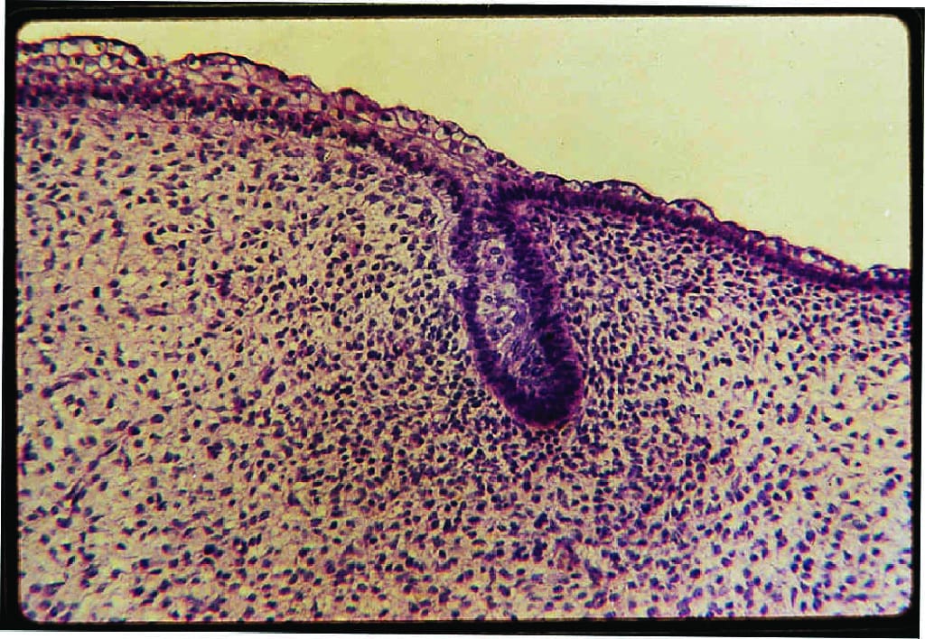 Tooth Development Slides