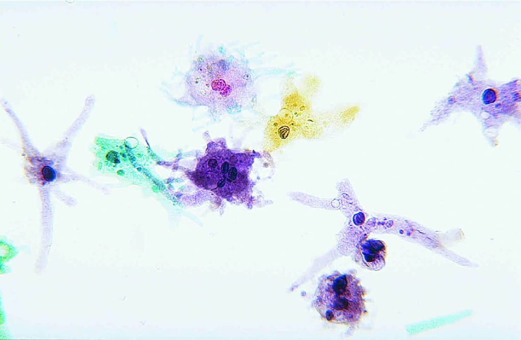 Amoeba Proteus Selected Slide