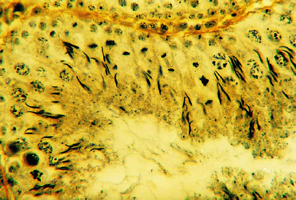 Testis, Spermatogenesis, Mammal Slide