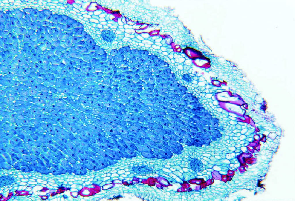 Root Nodules, Legume Bacteria Slide