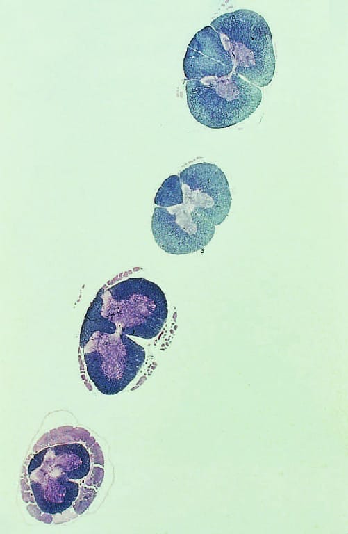 Spinal Cord, Four Levels Slide