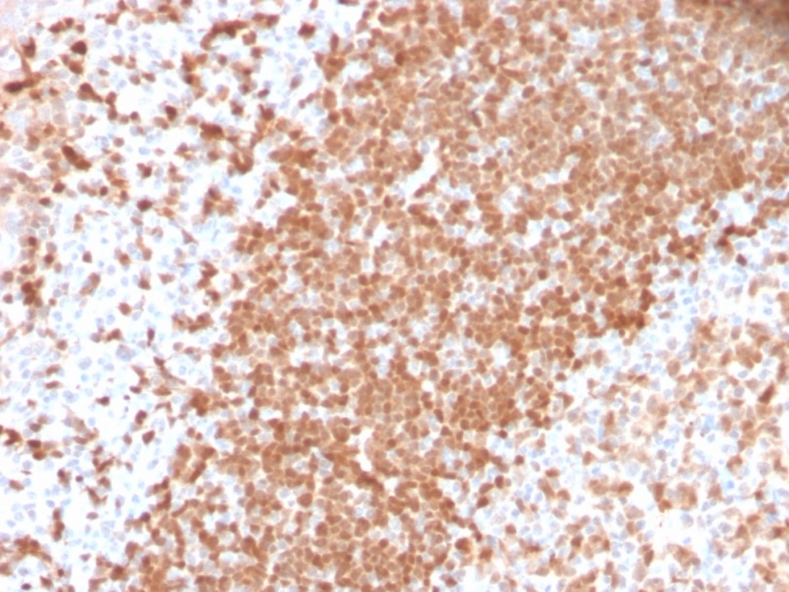 Anti-TCL1 Rabbit Recombinant Antibody [clone: TCL1/2747R] | VWR, part ...