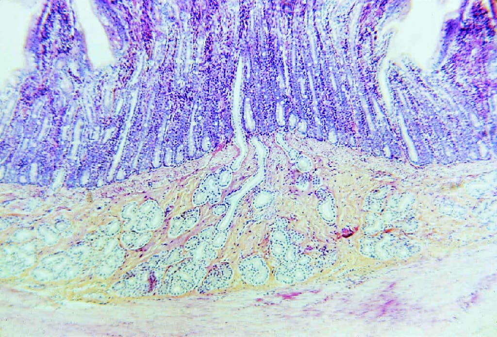 Duodenum Slide