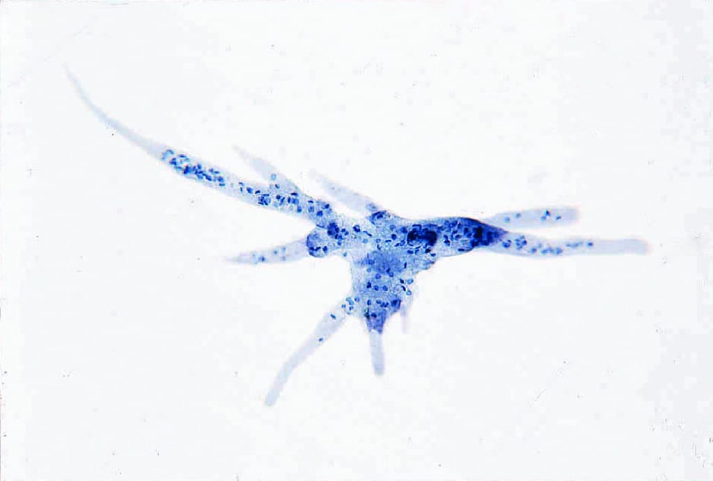 Pelomyxa Carolinense Slide