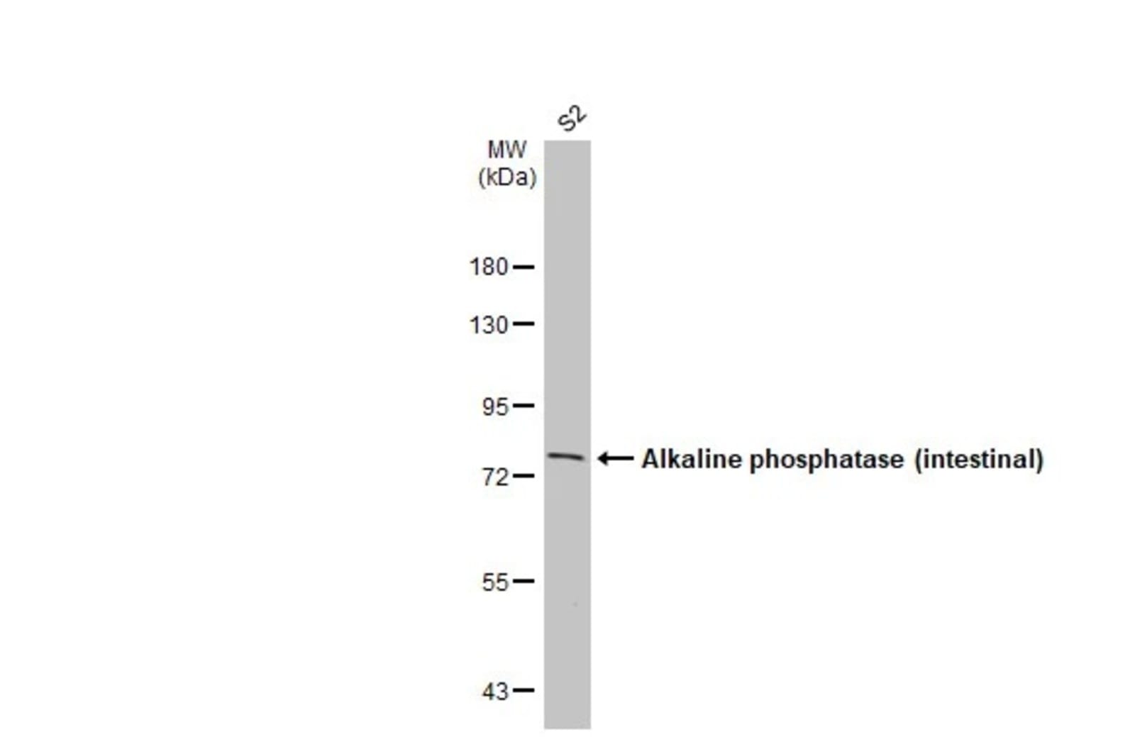 Anti-intestinal alkaline phosphatase Rabbit Monoclonal Antibody [clone ...