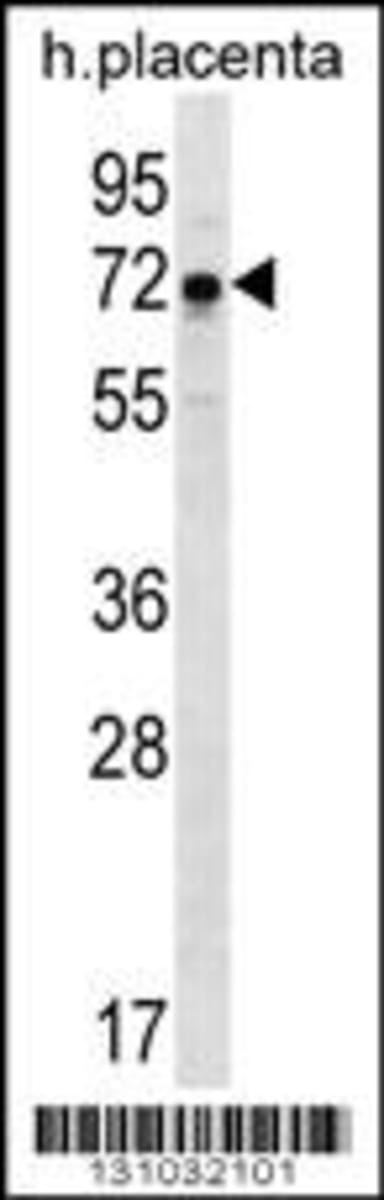 Anti-GNE Rabbit Polyclonal Antibody | VWR, part of Avantor
