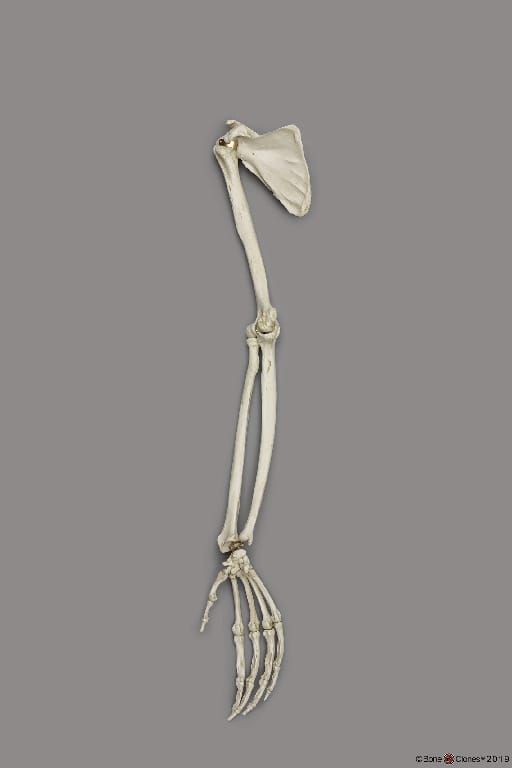BoneClones® Limbs for Anatomical Comparison
