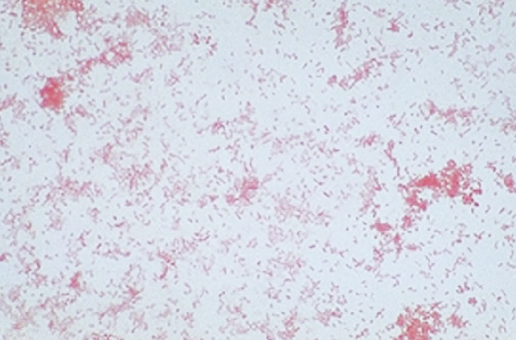 Ward's® Live Serratia marcescens D1 Culture