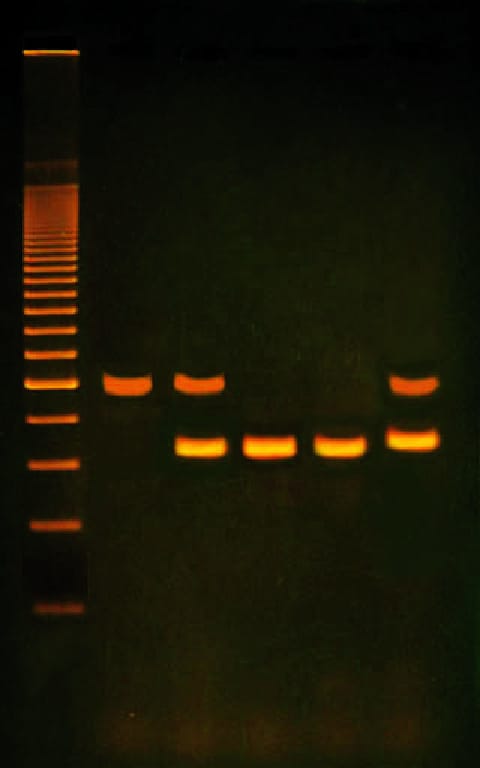 PCR Based Alu Human DNA Typing