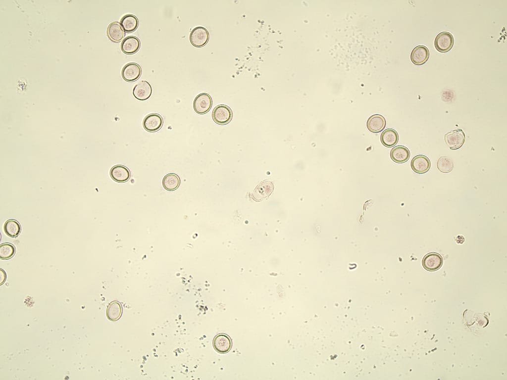 Tapeworm, Eggs Slide