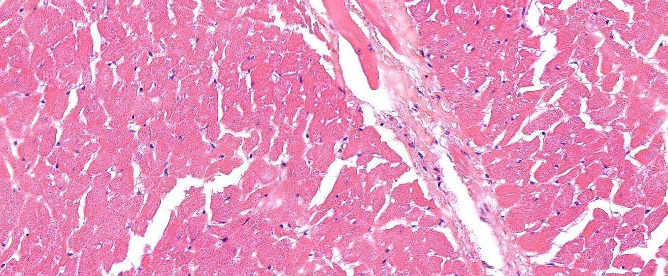 Cardiac Muscle, Mammal Slide