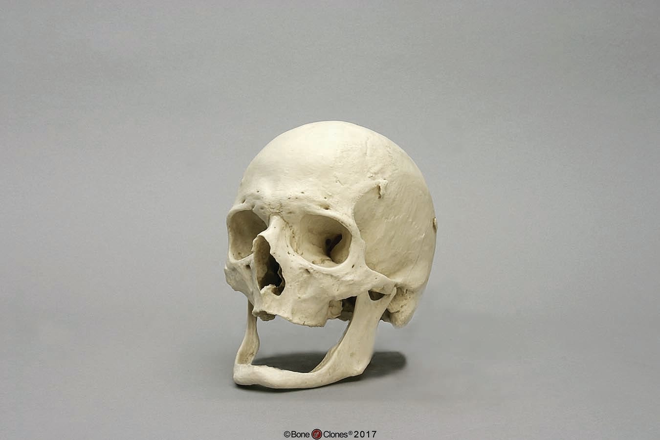 BoneClones® Regional Human Skulls