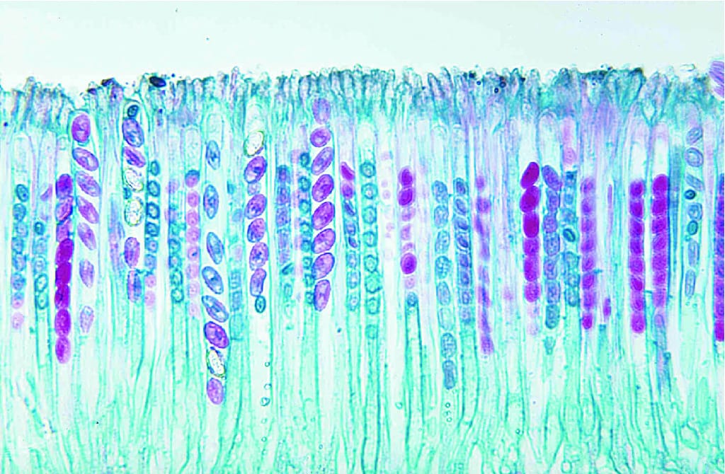 Peziza, Apothecia Slide