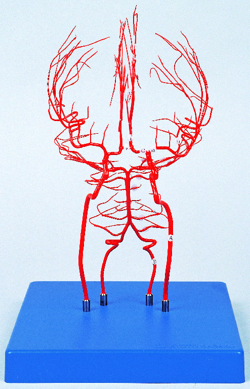Arteries of the Brain Model