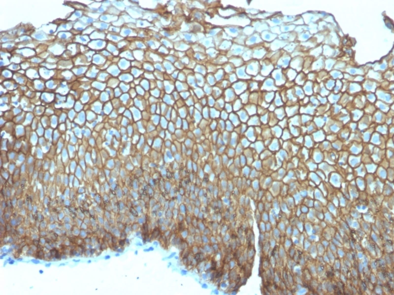 Anti-Desmoglein 3 Mouse Monoclonal Antibody [clone: DSG3/2839] | VWR ...
