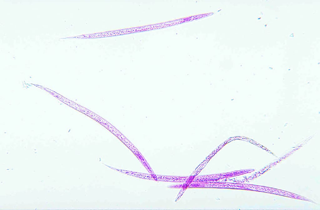 Typical Nematode Slide