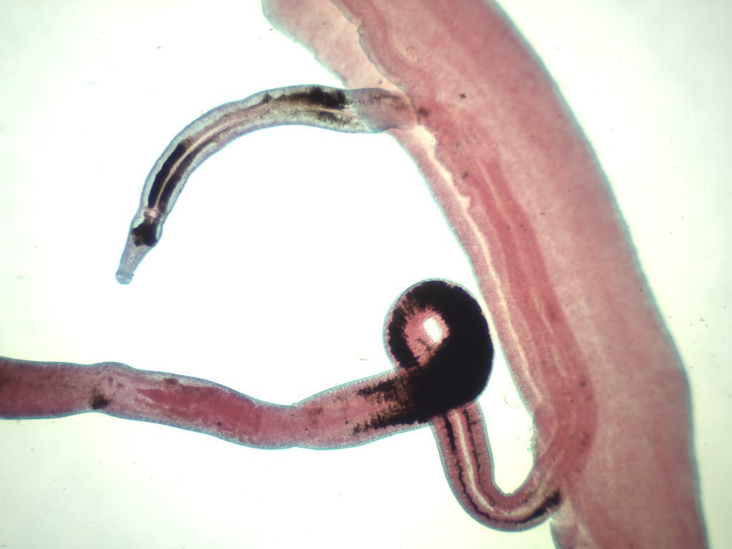 Schistosoma japonicum, Male/Female Slide