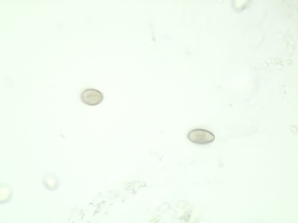 Clonorchis sinensis, Egg, Whole Mount Slides