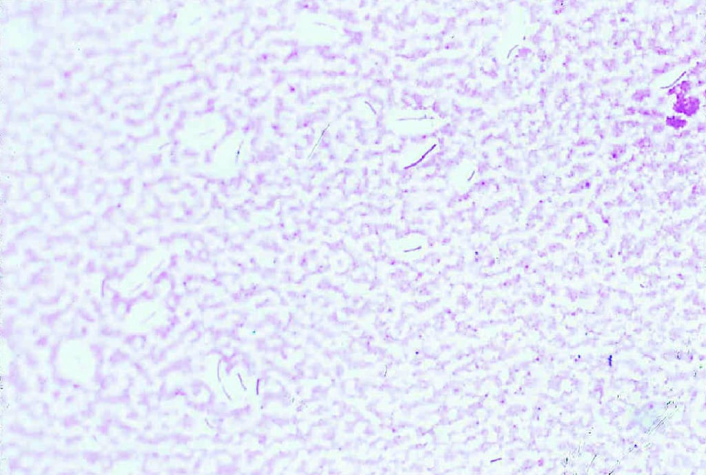 Ward's® Live Novosphingobium capsulatum (Flavobacterium capsulatum) Culture