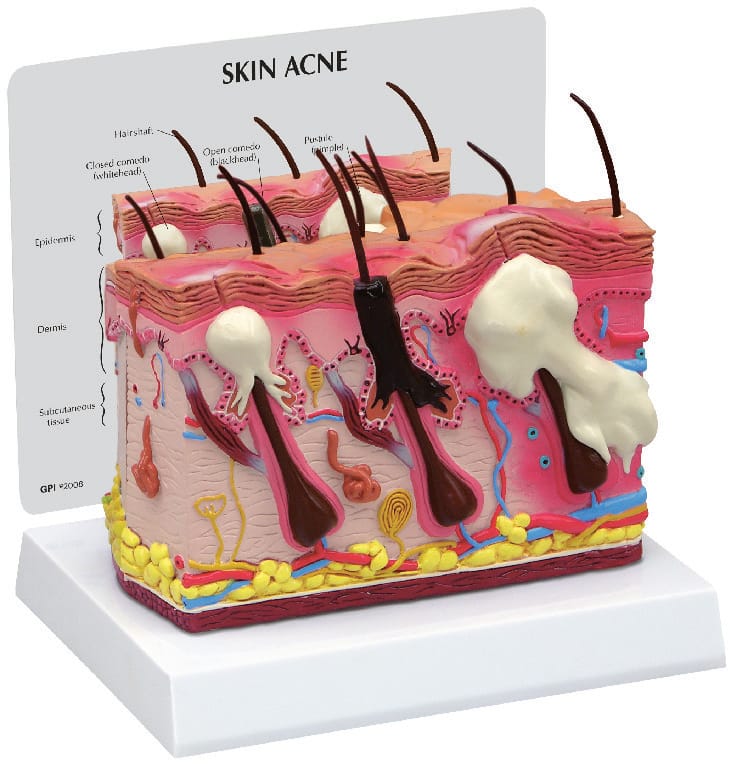 GPI Anatomicals® Skin Normal/Acne Model