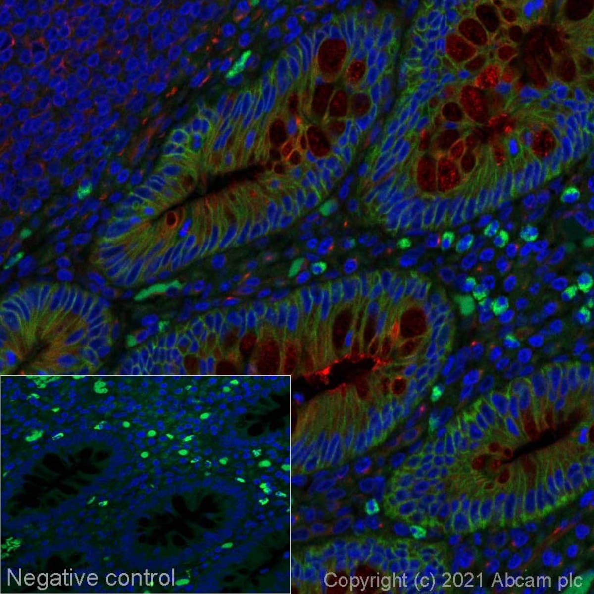 Anti-Integrin alpha 2 Rabbit Monoclonal Antibody [clone: EPR17338 ...