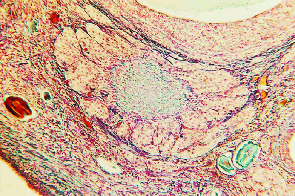 Ovary, Corpus Luteum Slide