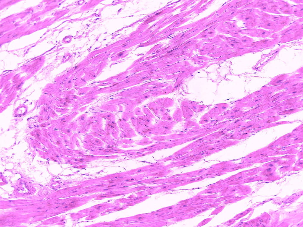 Muscle Types, Composite, Human Slide