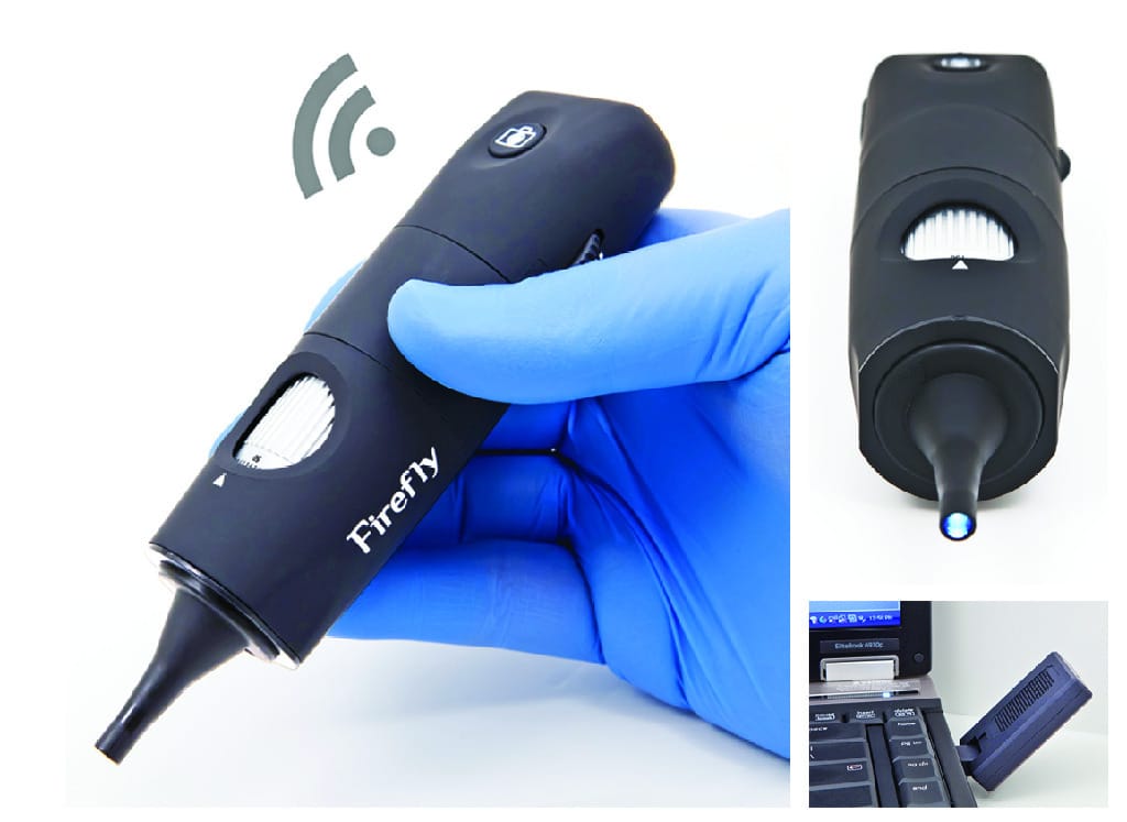 Firefly Digital Video Otoscope
