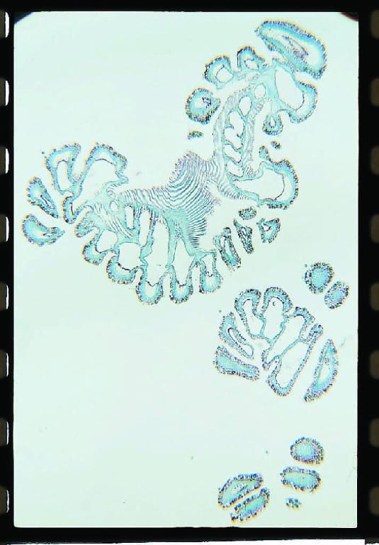 Physalia, Tentacle Slide