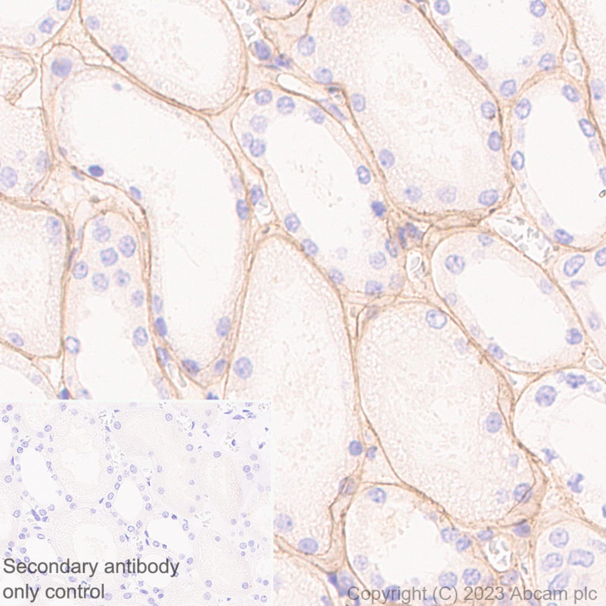 Anti-Collagen IV Rabbit Recombinant Multiclonal Antibody [clone: RM1065 ...