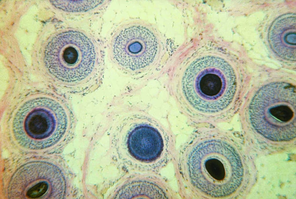 Adult Scalp Slide