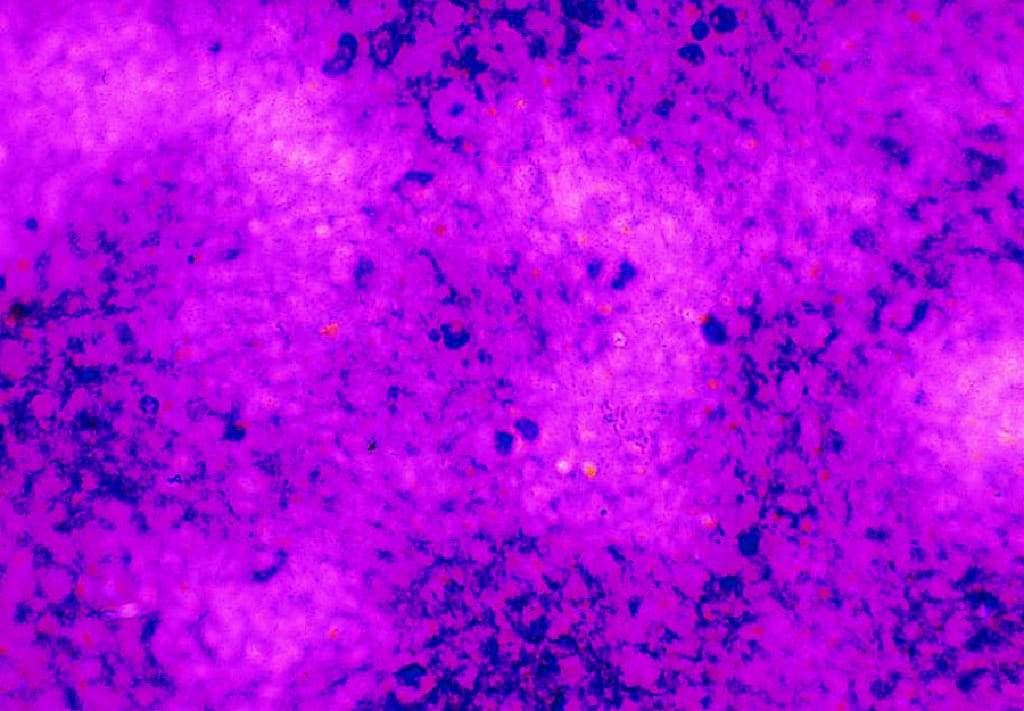 Ward's® Live Streptococcus pneumoniae Culture - PATHOGEN