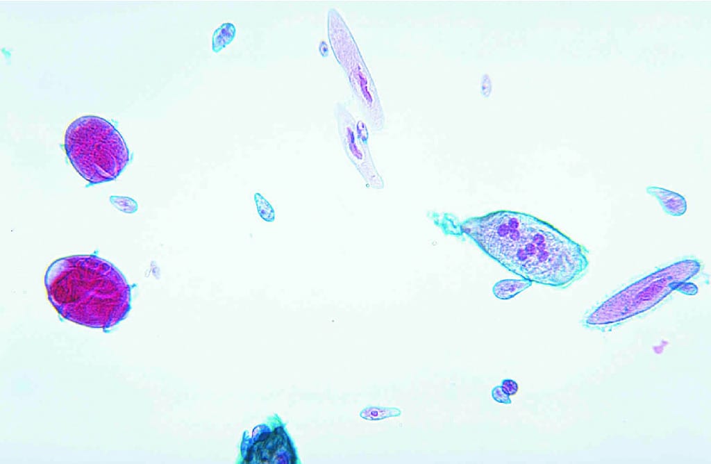 Mixed Ciliates Slide