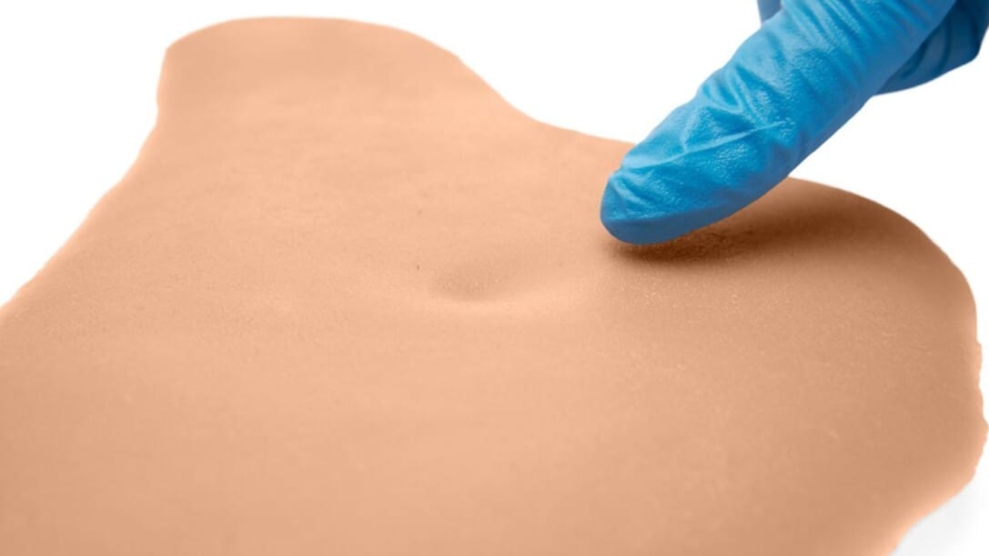Medicor® Sticky Wounds