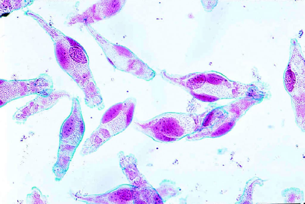 Rotifers, Mixed Slide