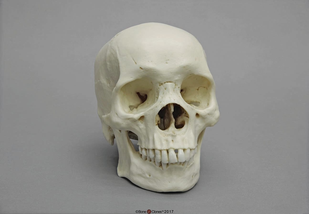 BoneClones® Regional Human Skulls