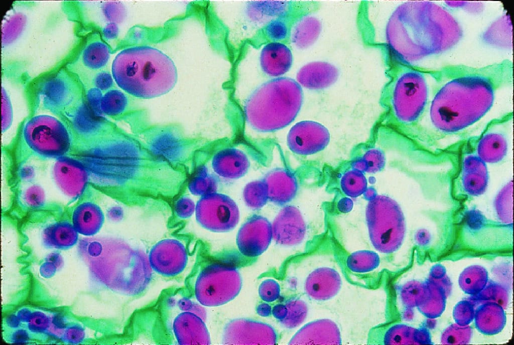 Solanum, Tuber Slide