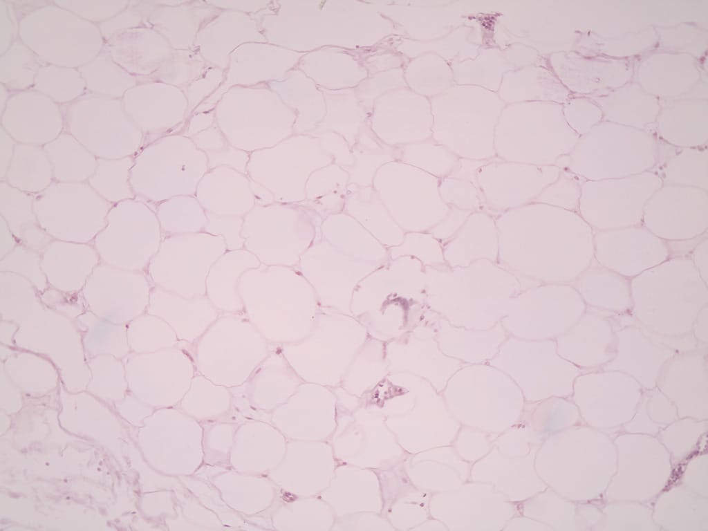 Adipose Tissue