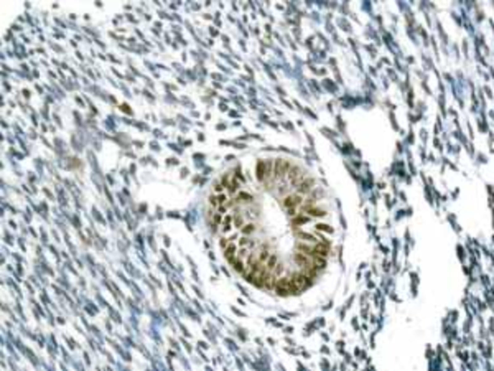 Anti-ILF2/NF45 Rabbit Monoclonal Antibody [clone: EPR10694(B)] | VWR ...