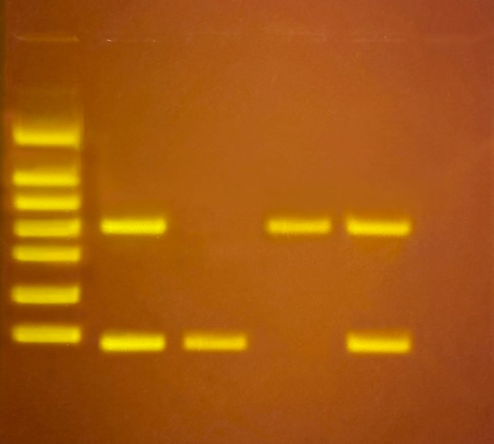 Edvotek® Silent Signals: Tracking Disease Through PCRWastewater Testing