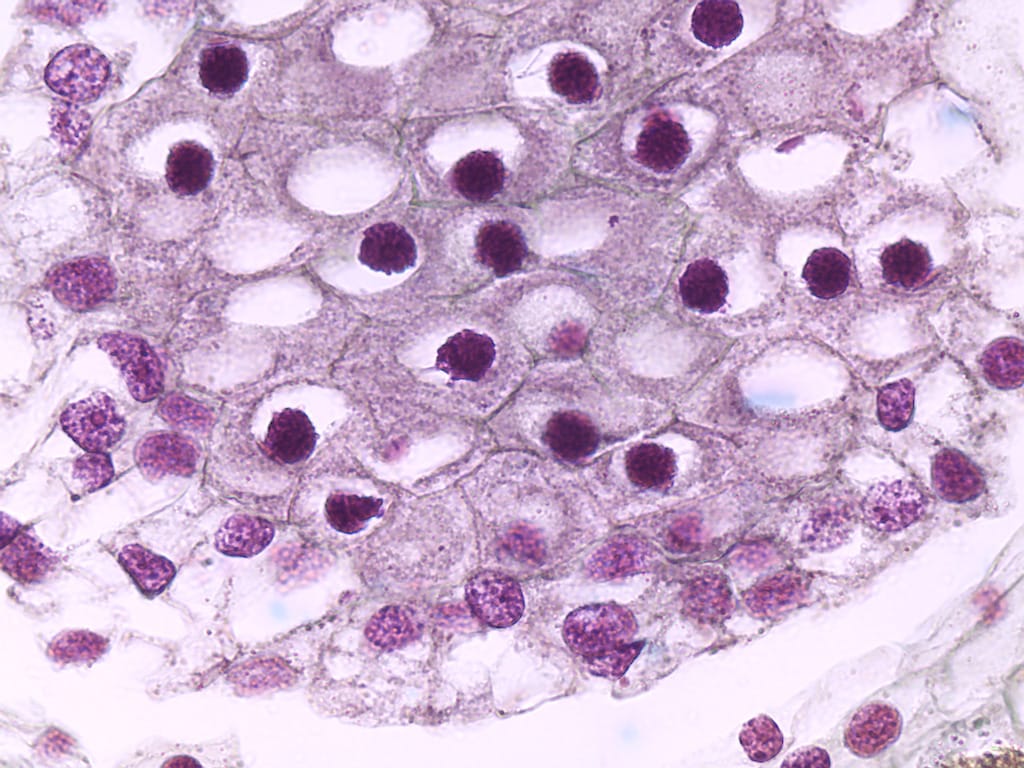 Lily Meiosis, Synizesis Slide