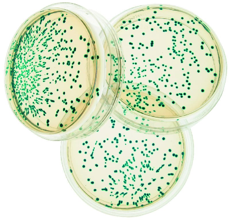 Transformation of Escherichia coli Lab, Edvotek